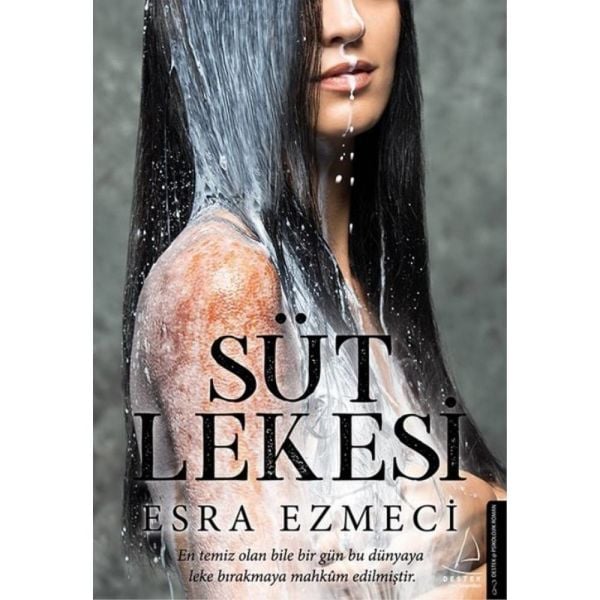 Süt Lekesi